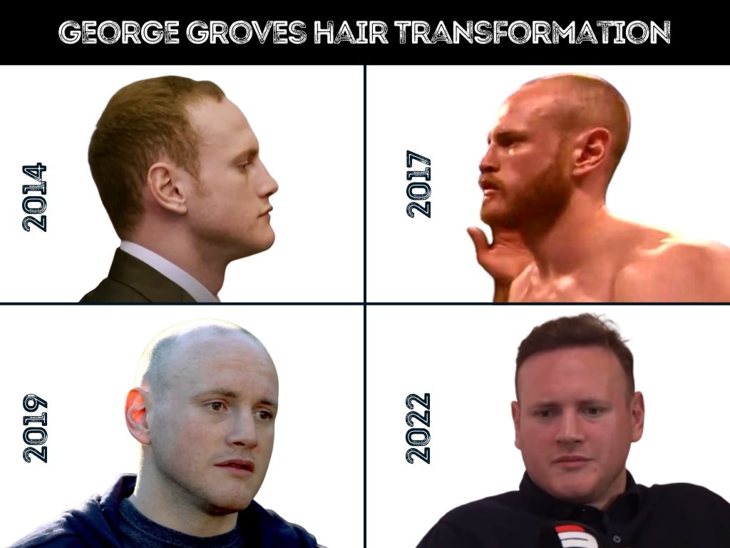 george groves - hair transformation