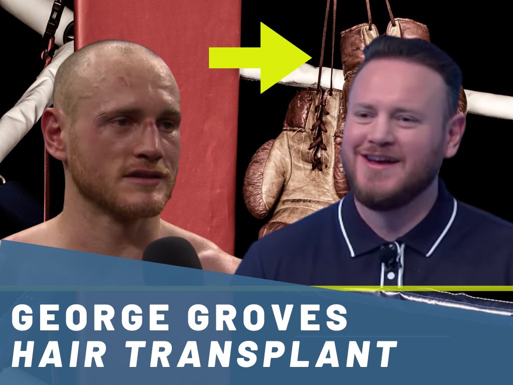 george groves hair transplant analysis banner