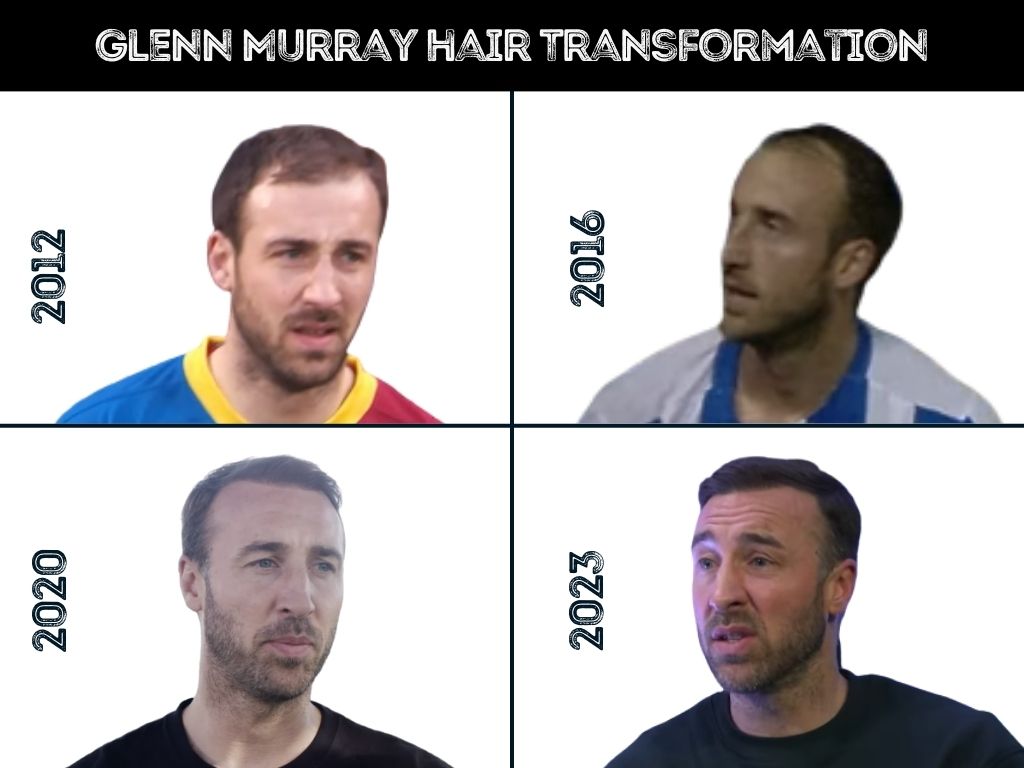 glenn murray hair transformation