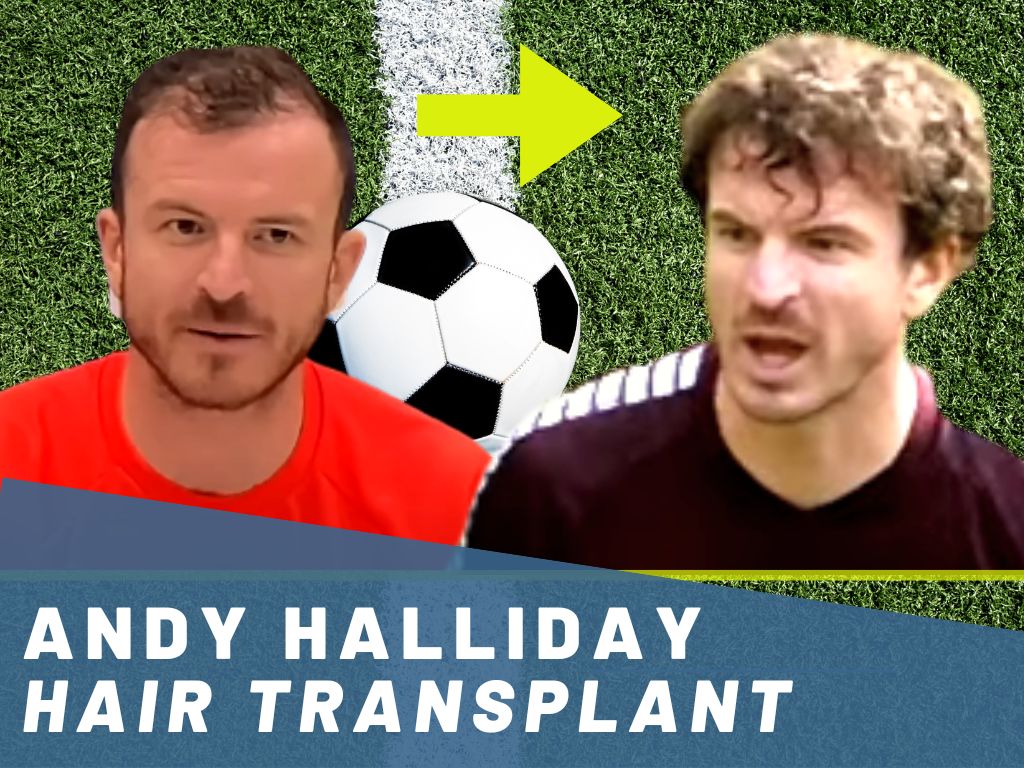 andy halliday - hair transplant analysis banner