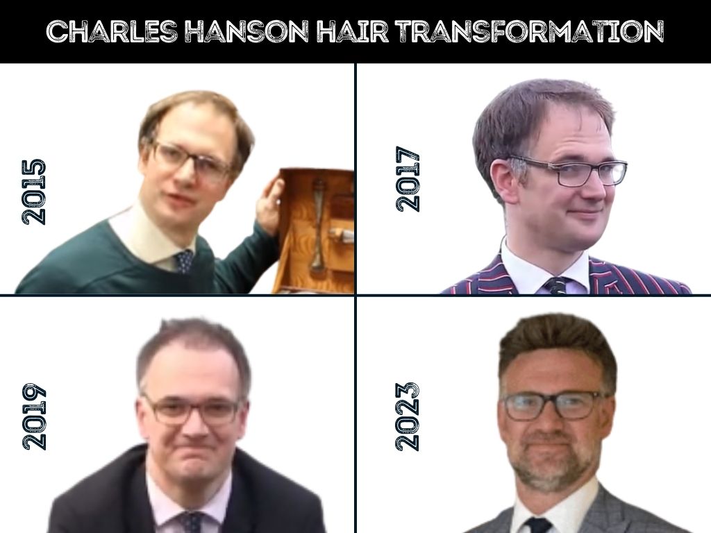 charles hanson - hair transformation