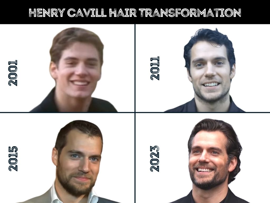henry cavill - hair transformaton years