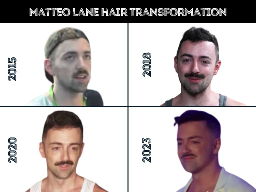 matteo lane hair transformation and hair loss