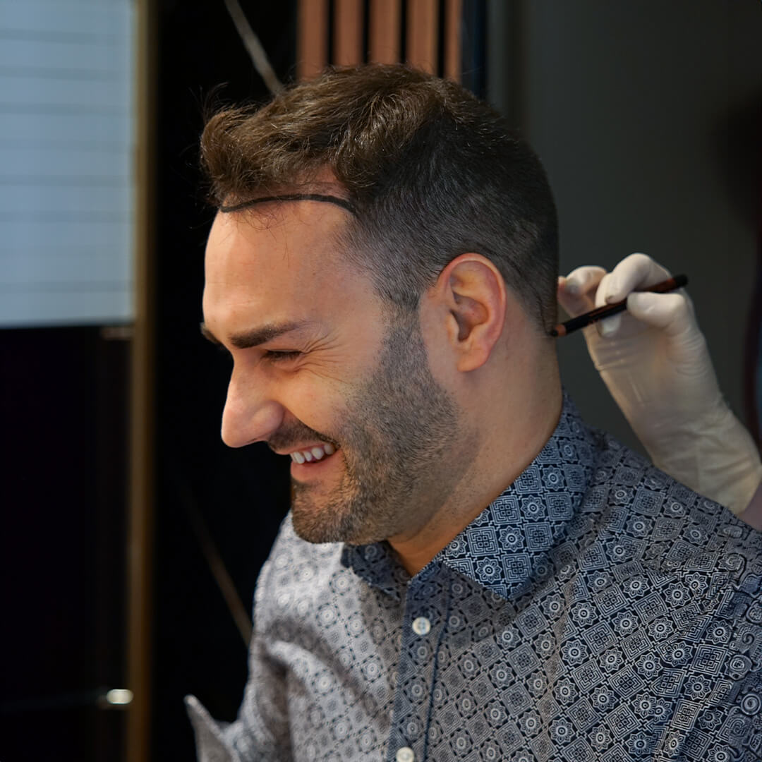 waw hair transplant candidate