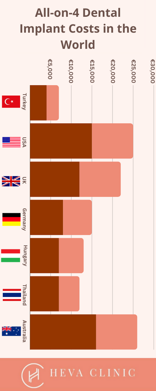 All-on-4 Dental Implant Costs in the World