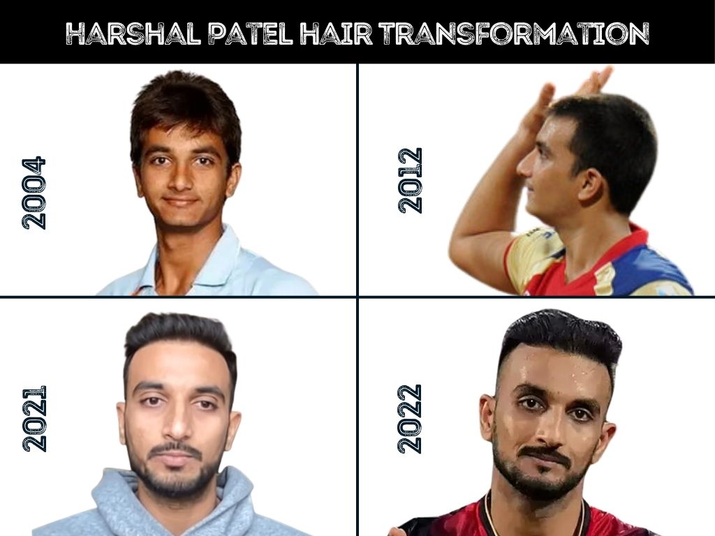 Harshal Patel hair Transformation