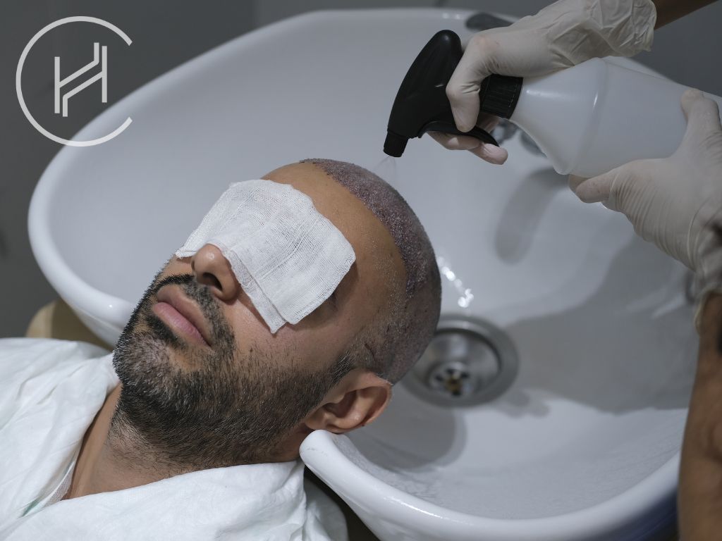 first washing after hair transplant at heva clinic istanbul