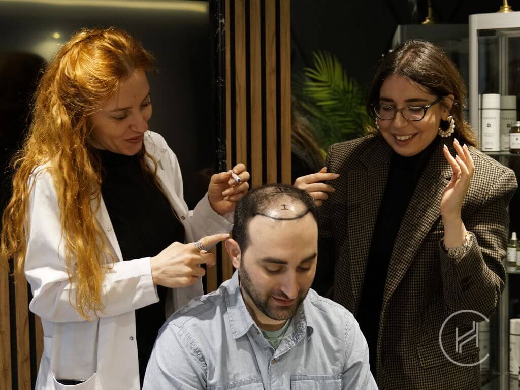 hair transplant norwood 5 patient during consultation hair transplant norwood 5 patient during consultation