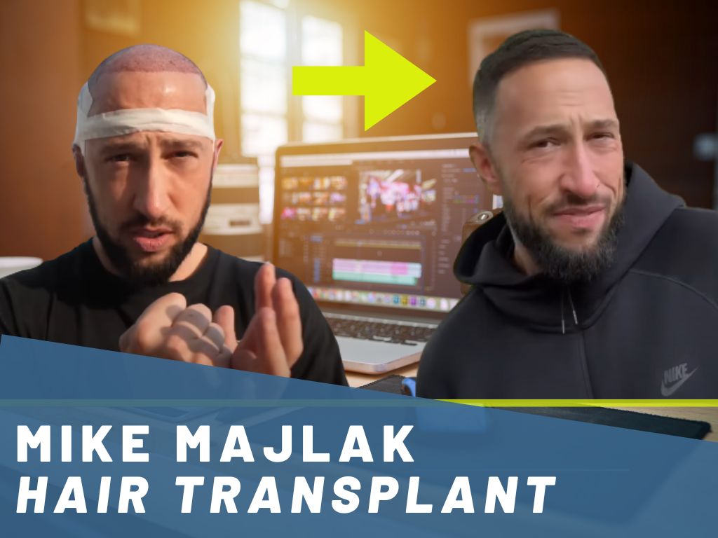 mike majlak - hair transplant analysis banner