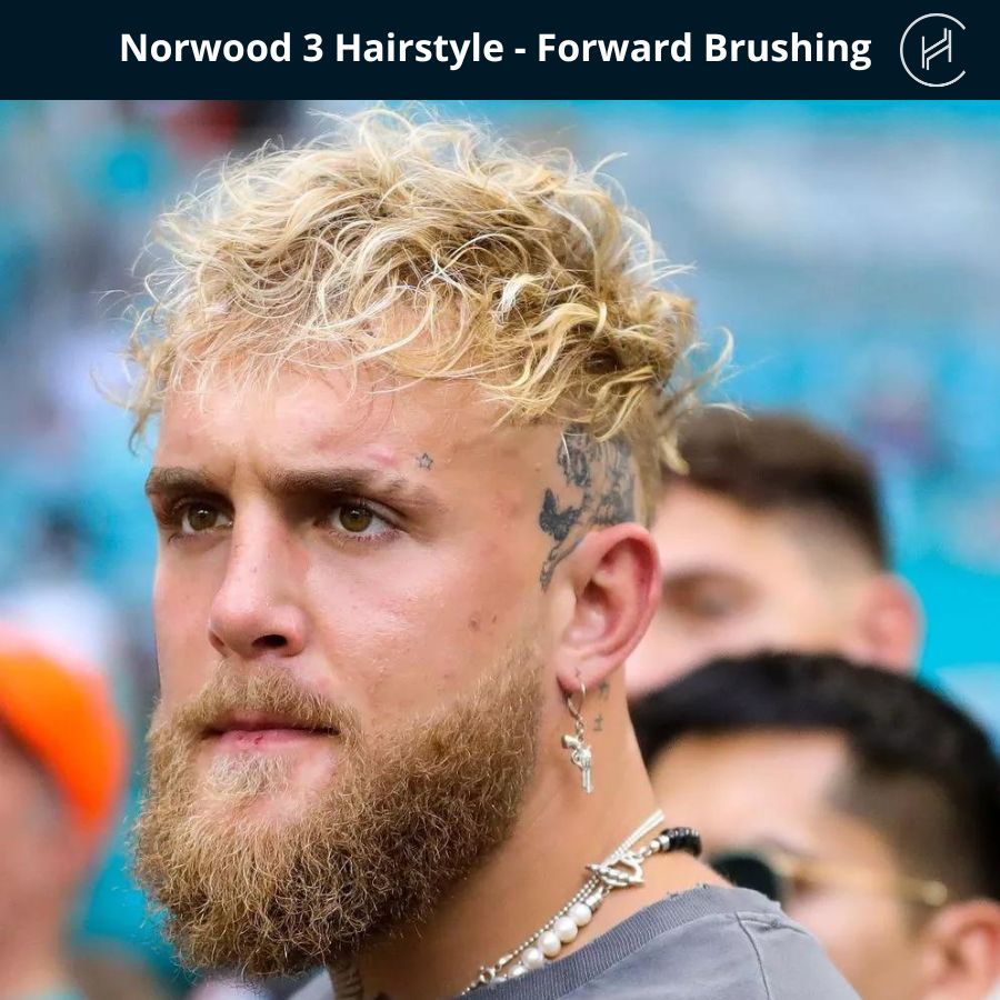 Norwood stage 3 Hairstyle - Forward Brushing