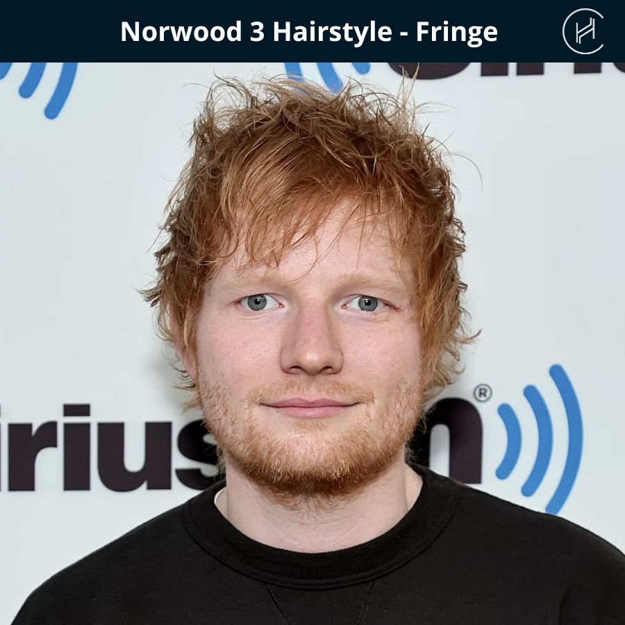 Norwood stage 3 Hairstyle - Fringe