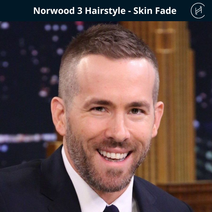 Norwood stage 3 Hairstyle - Skin Fade