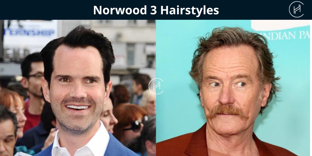 Norwood stage 3 Hairstyles - 2 examples