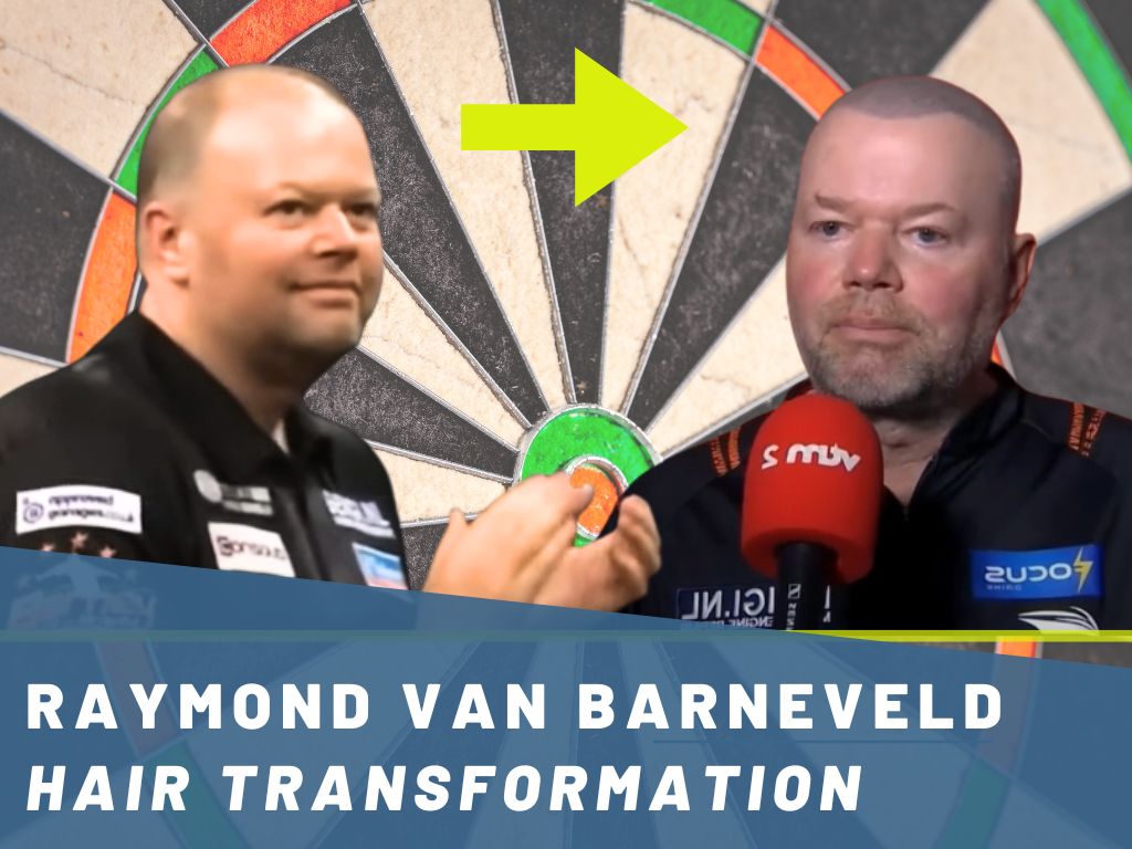 Raymond van Barneveld Hair Transformation Analysis Banner