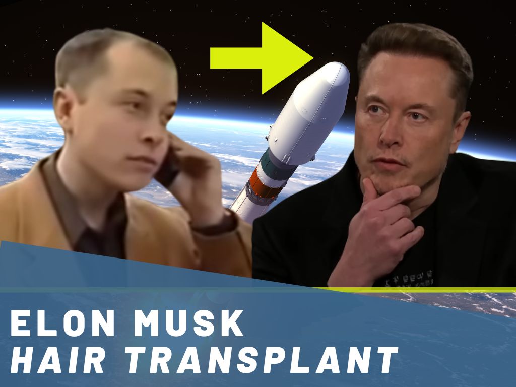 elon musk hair transplant analysis banner