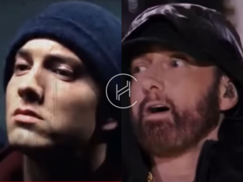 eminem-beard-transplant-before-and-after-result