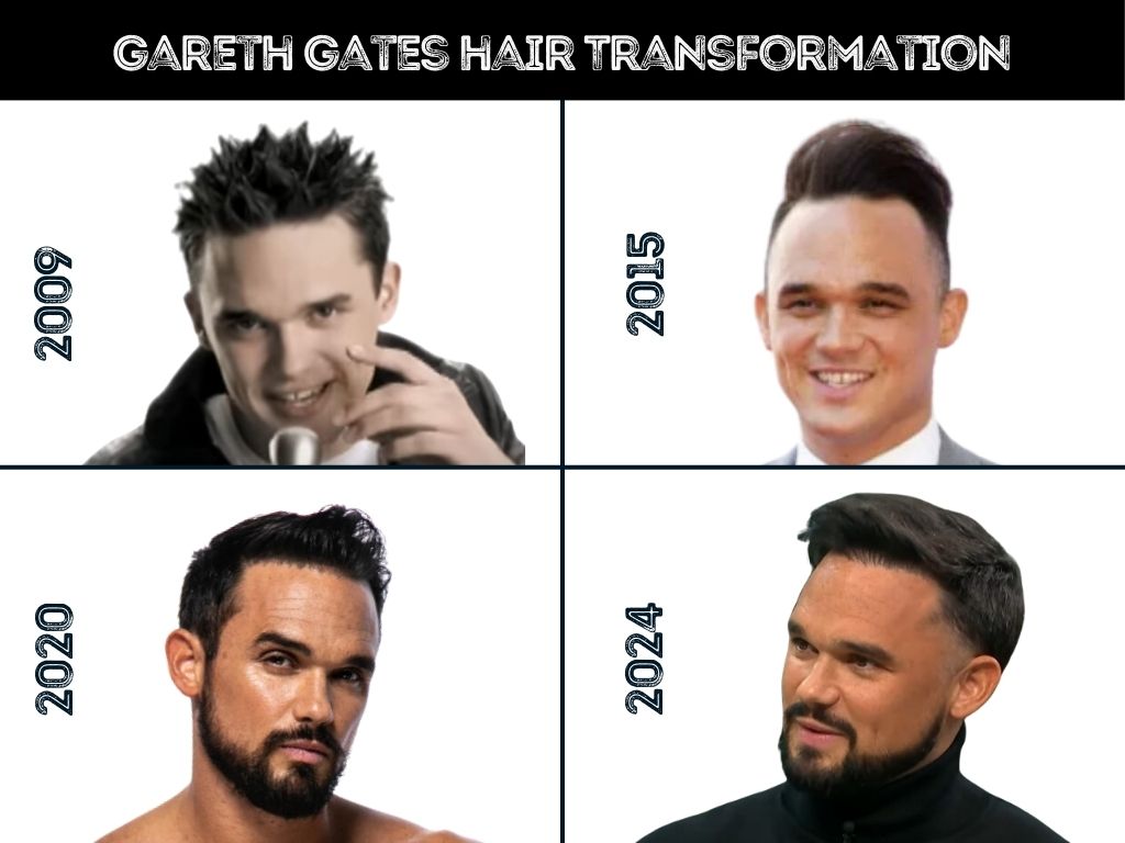 gareth gates hair transformation