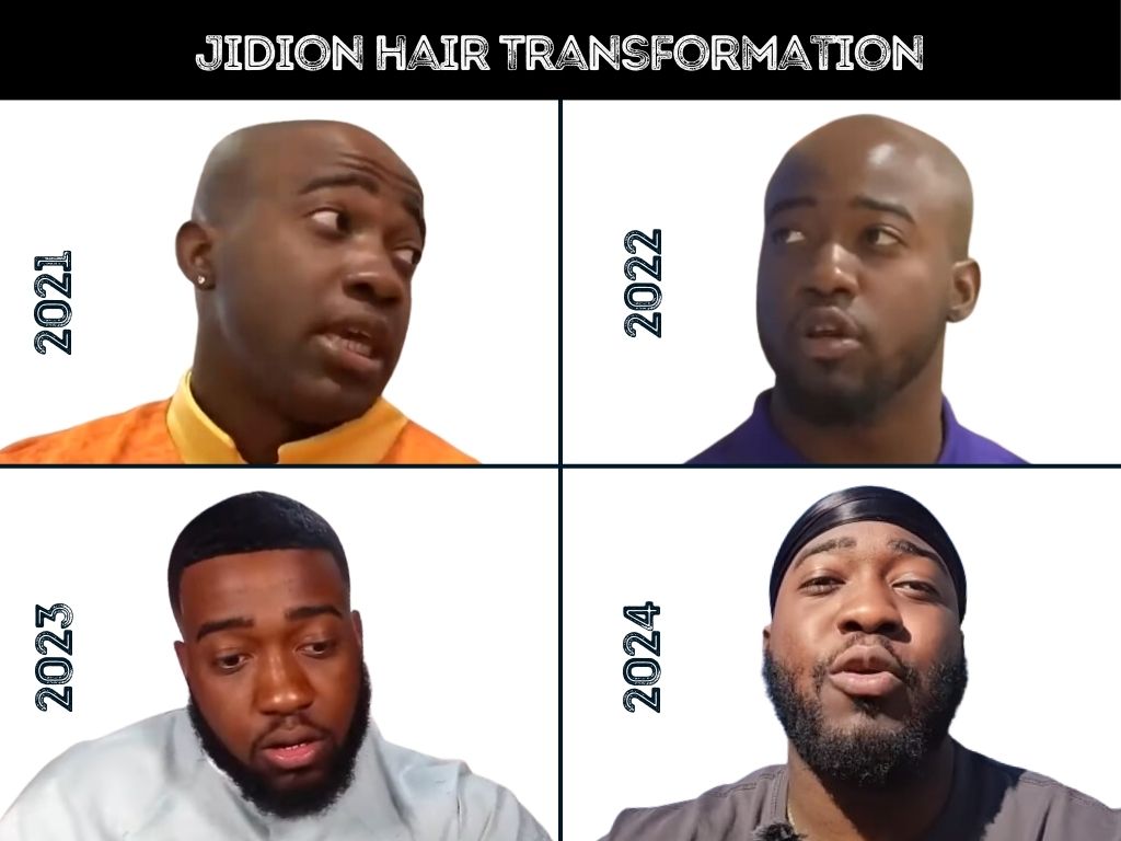 jidion hair transformation