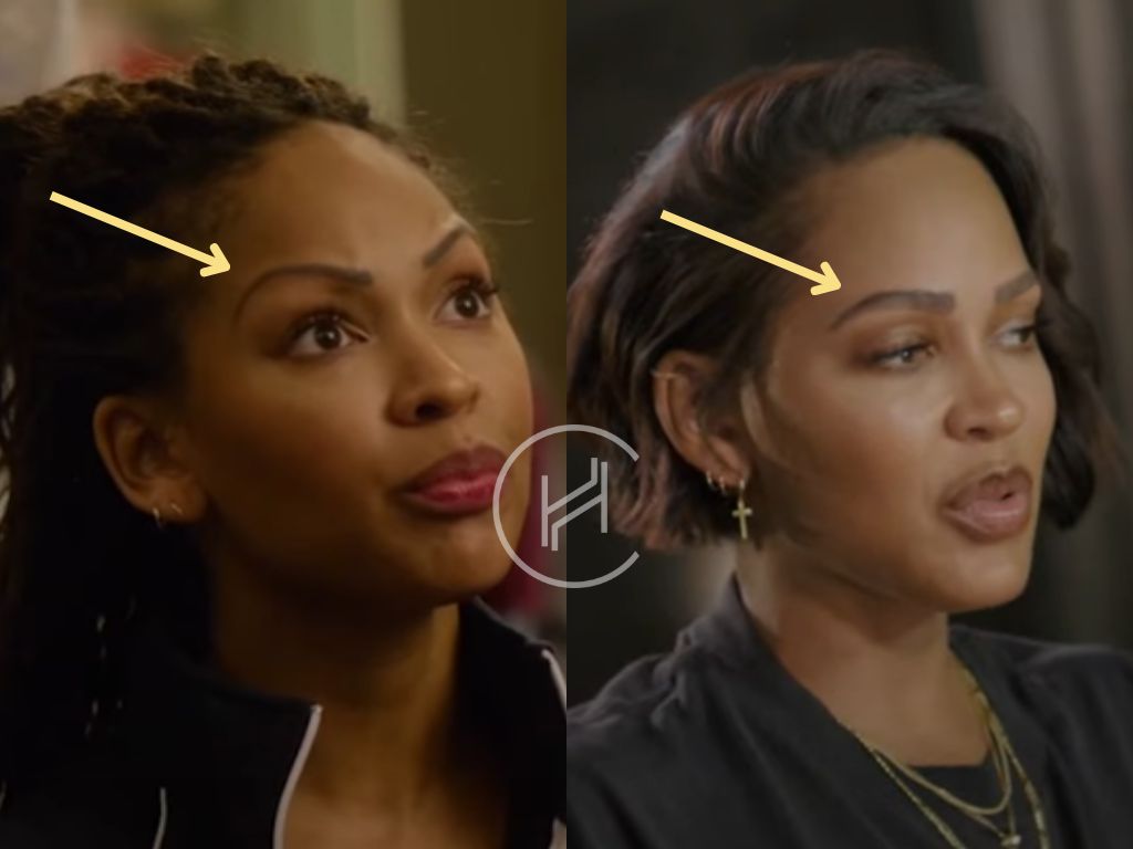meagan good - eyebrow transplant before after result