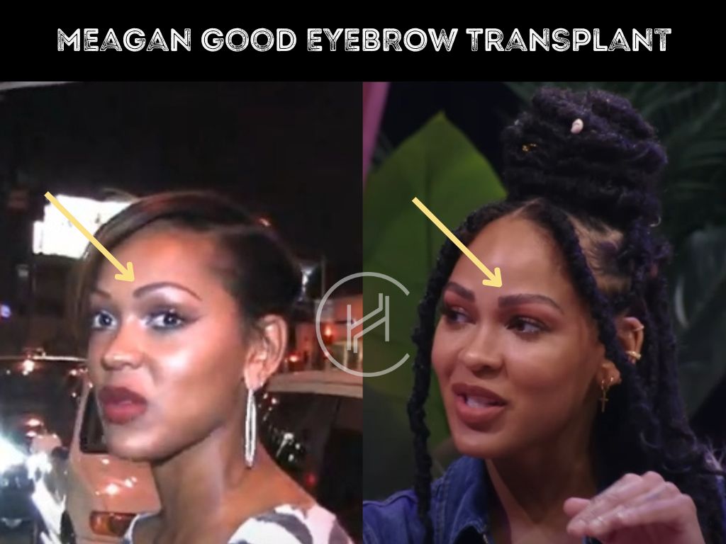 meagan good eyebrow transplant before and after