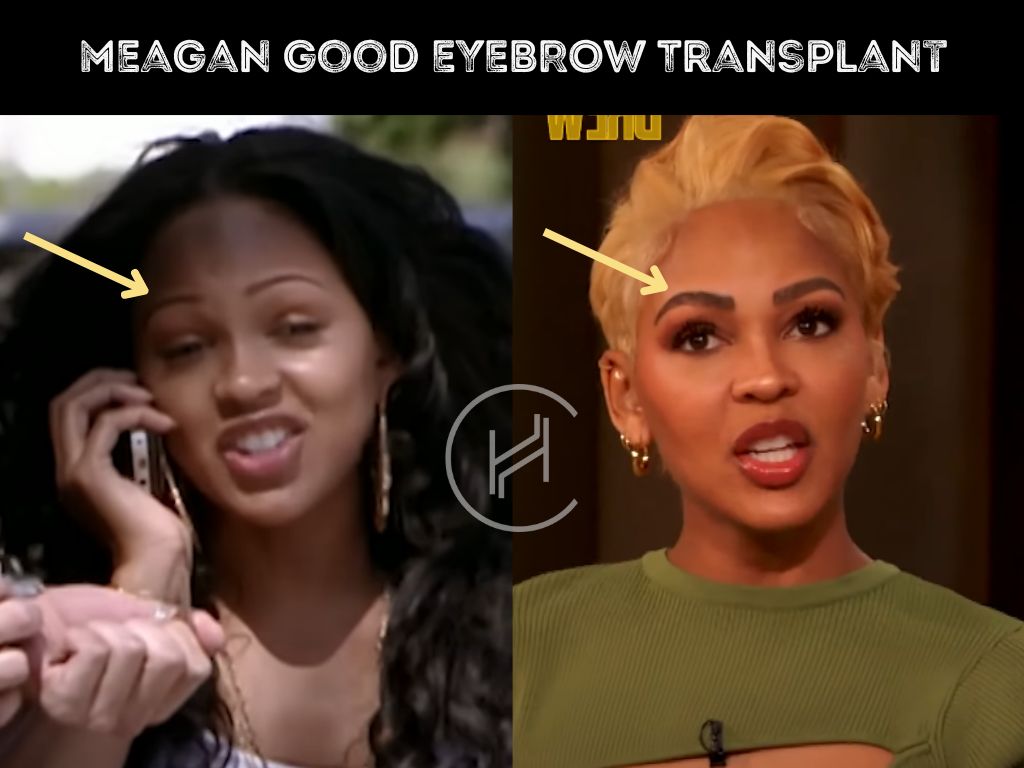 meagan good's eyebrow transplant before and after result