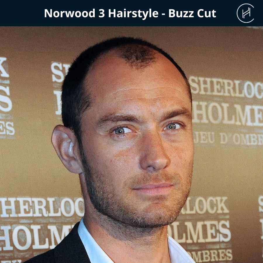norwood stage 3 hairstyle - buzz cut