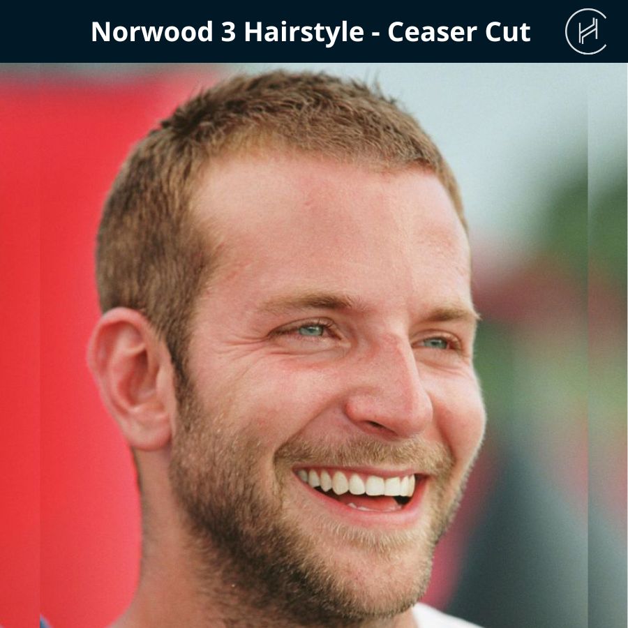 norwood stage 3 hairstyle - ceaser cut