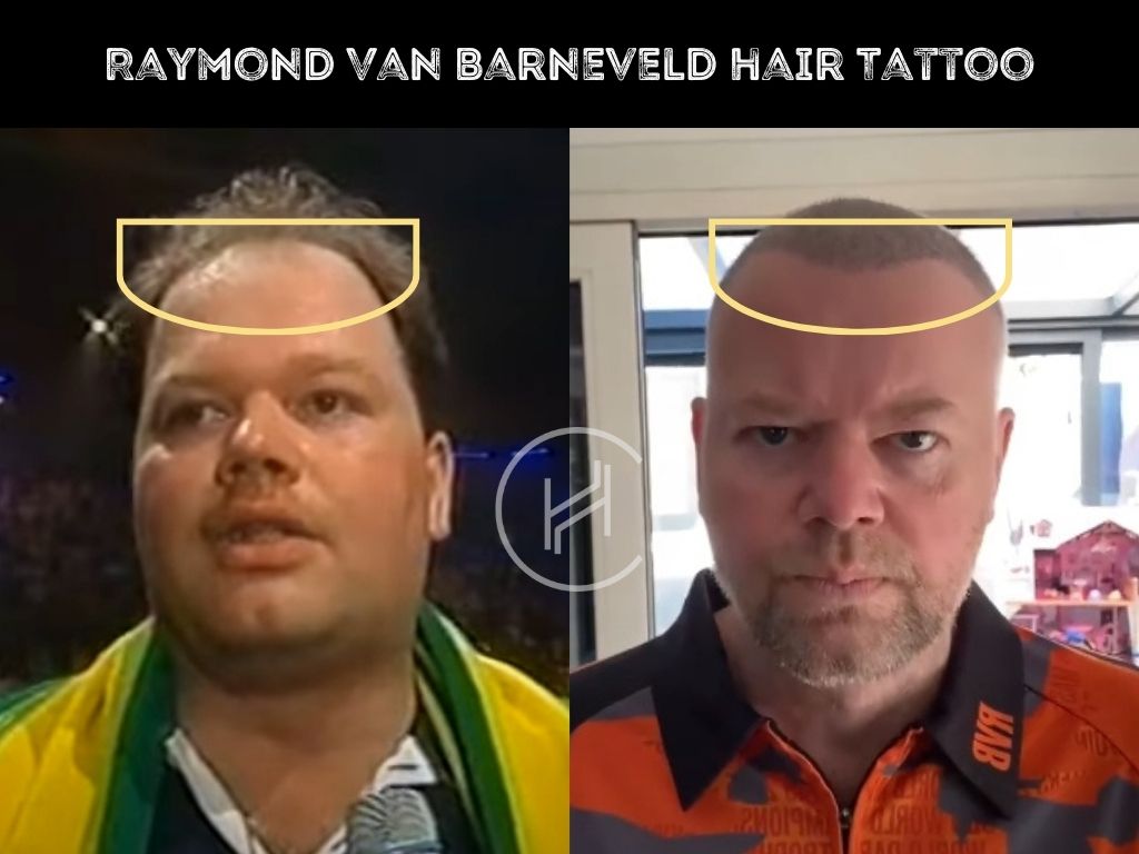 raymond van barneveld hair tattoo before after