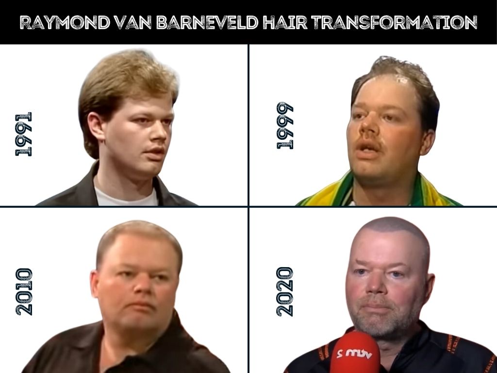 raymond -van-barneveld-hair-transformation