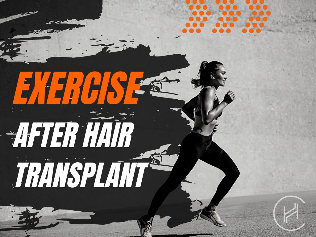 exercise after hair transplant banner