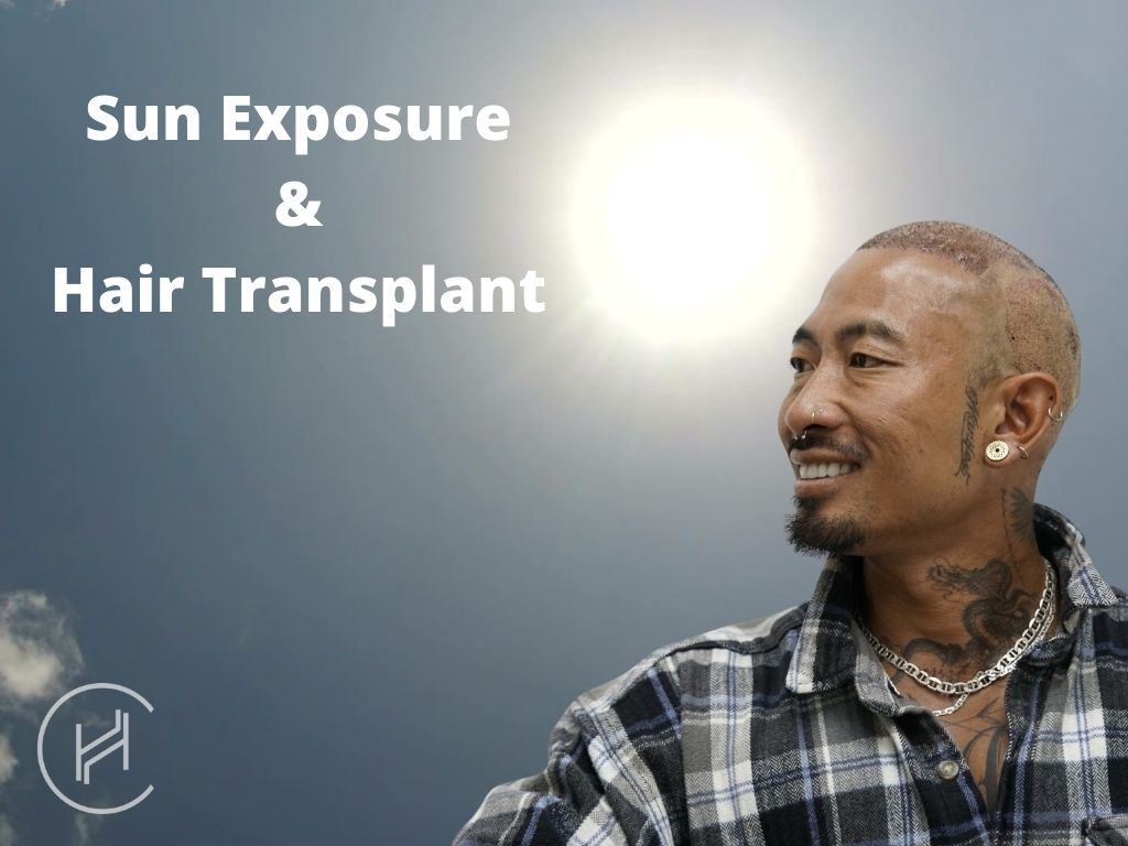 sun exposure and hair transplant banner