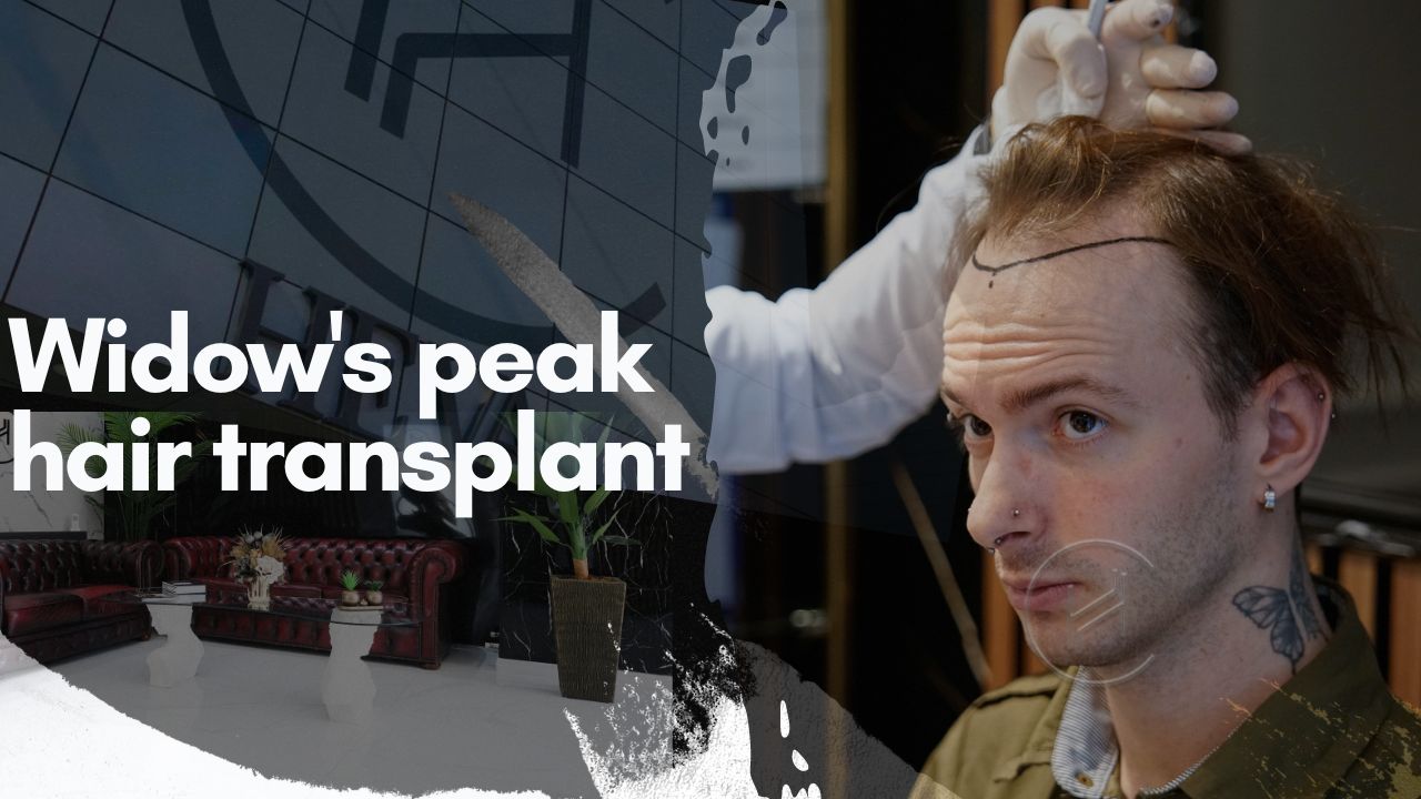Windows Peak Hair Transplant Banner