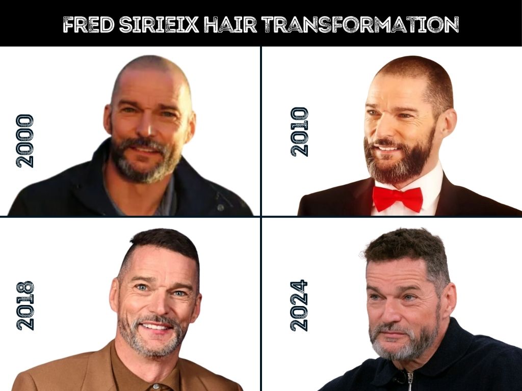 fred-sirieix-hair-transformation
