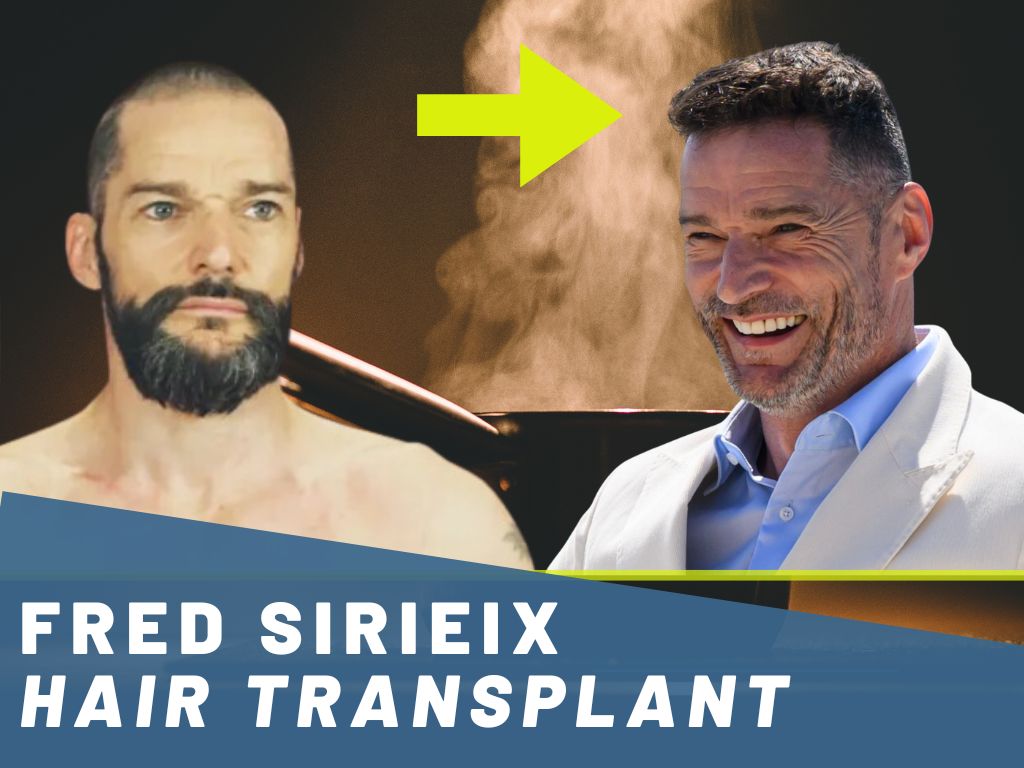 fred sirieix hair transplant analysis banner