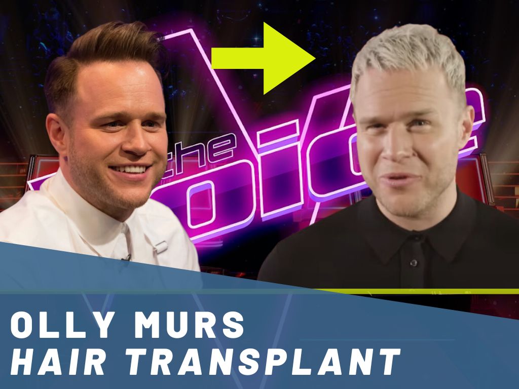 olly murs hair transplant analysis banner