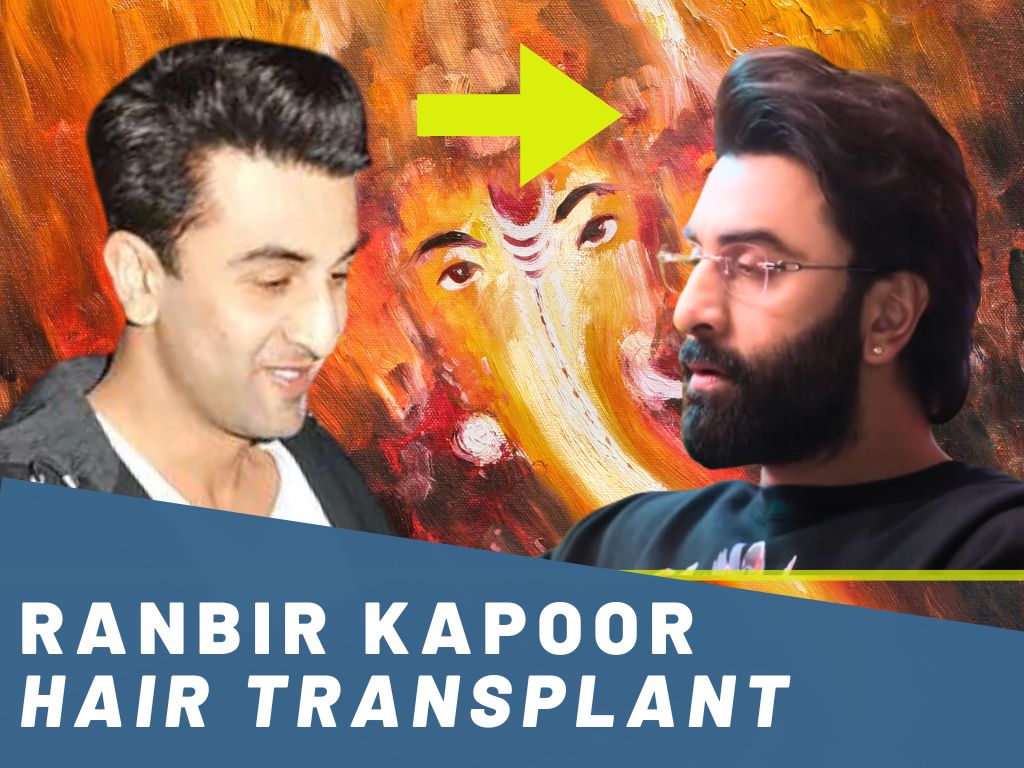 ranbir kapoor hair transplant analysis banner