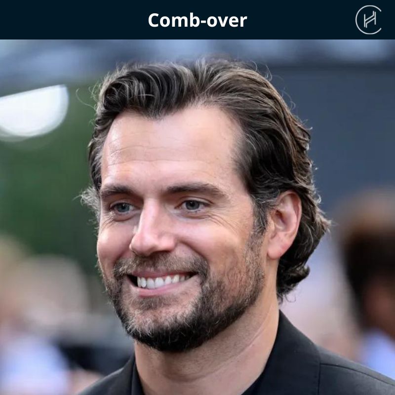 comb-over-hairstyle-for-balding-hair