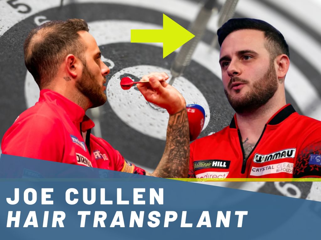 joe cullen hair transplant analysis banner