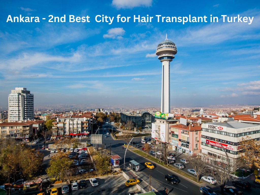 Ankara - 2nd Best City for Hair Transplant in Turkey