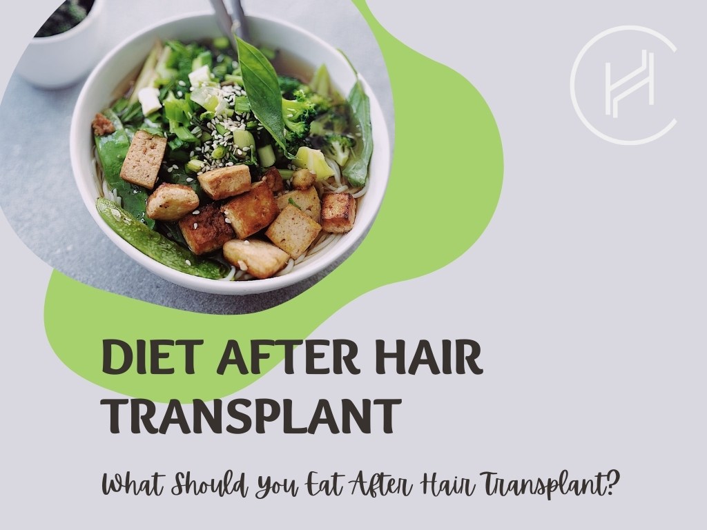 Diet After Hair Transplant Banner Diet After Hair Transplant Banner