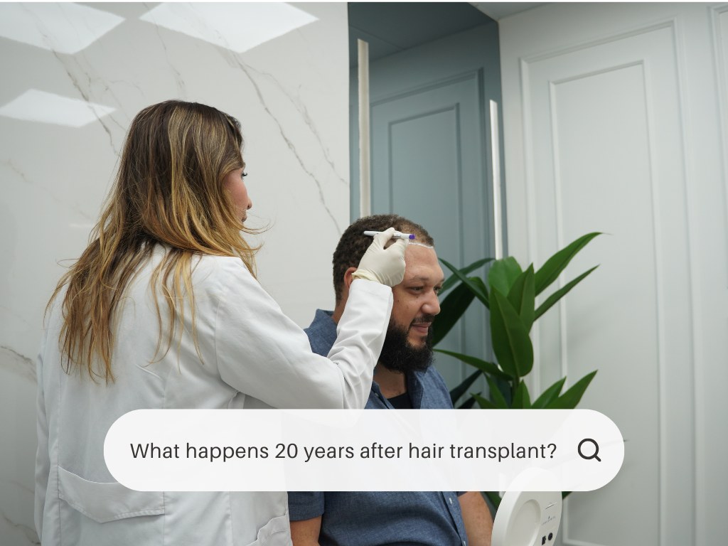 What happens 20 years after hair transplant What happens 20 years after hair transplant