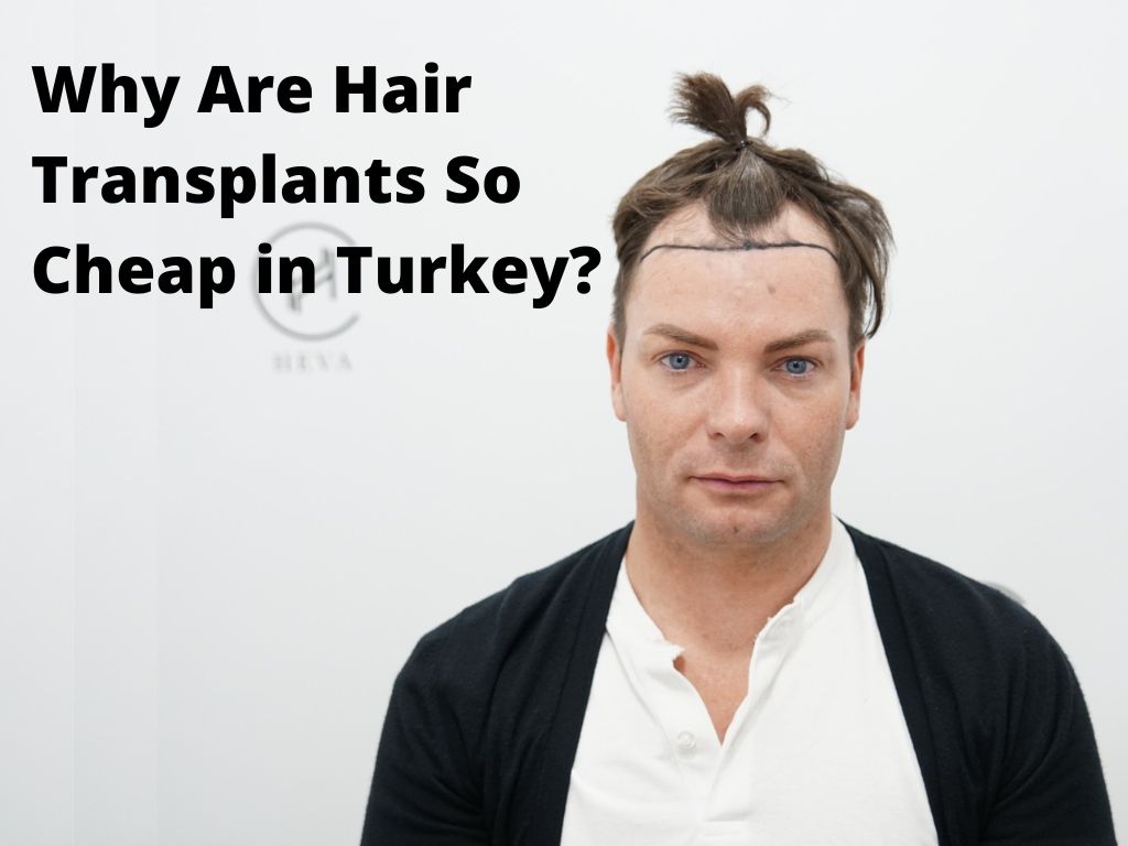 Why Are Hair Transplants So Cheap in Turkey - banner