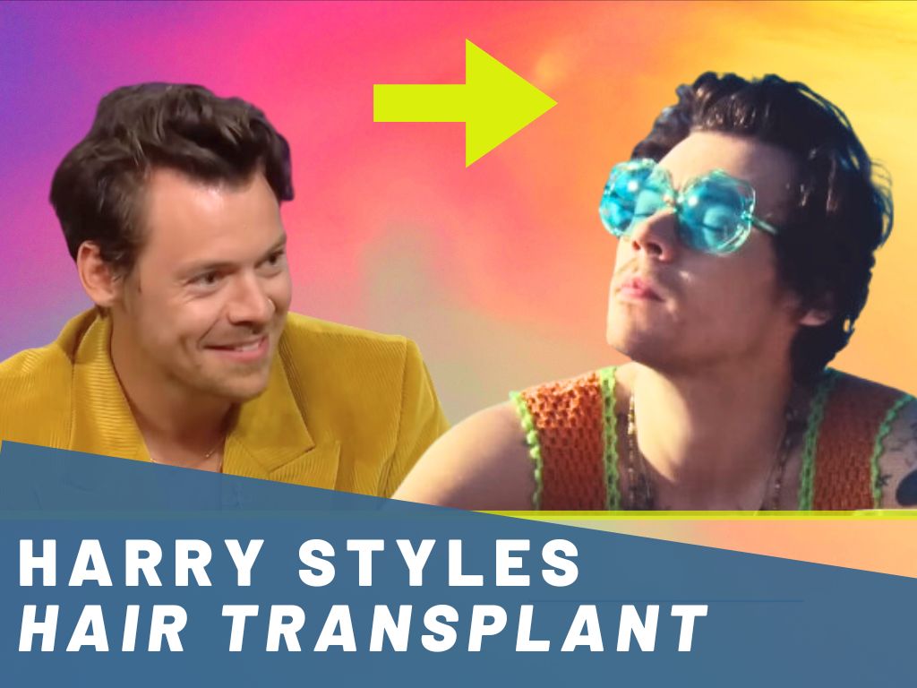 harry styles hair transplant analysis banner