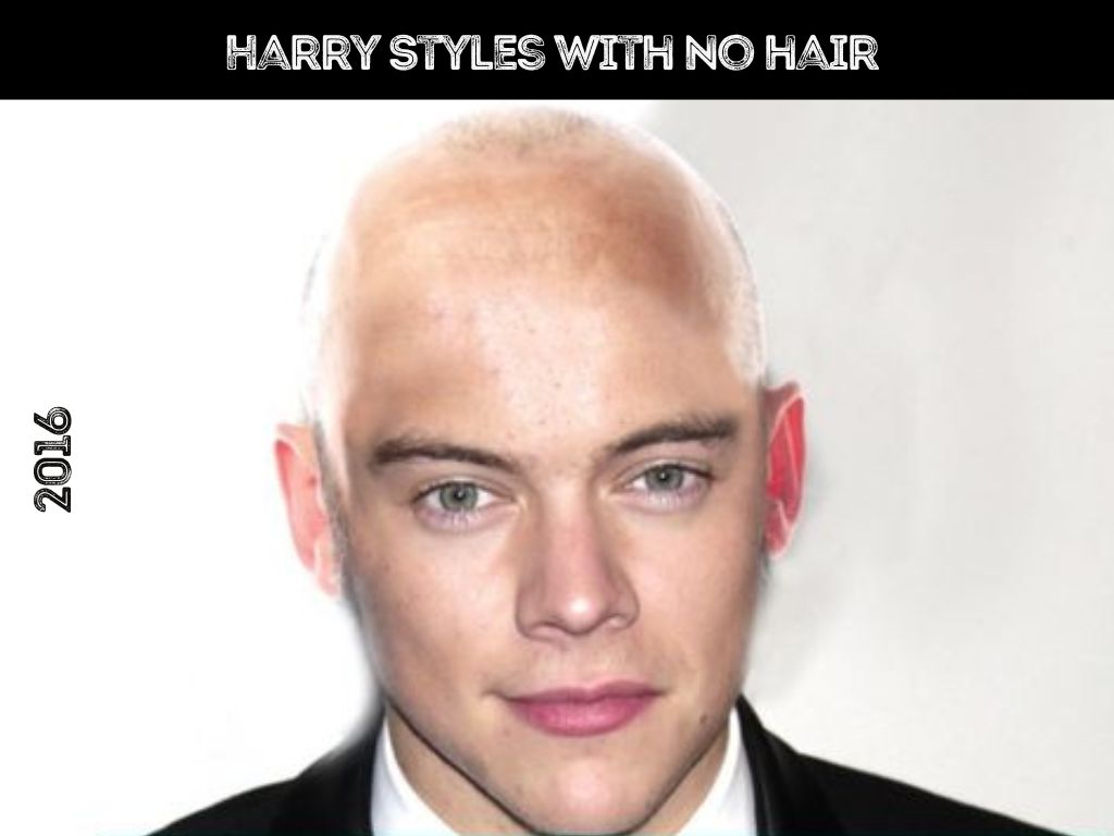 harry styles with no hair