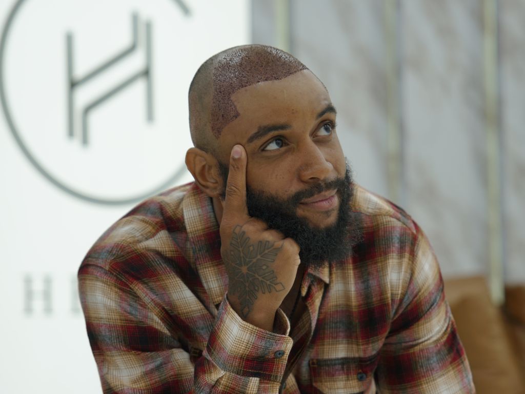 happy patient thinking after hair transplant at heva