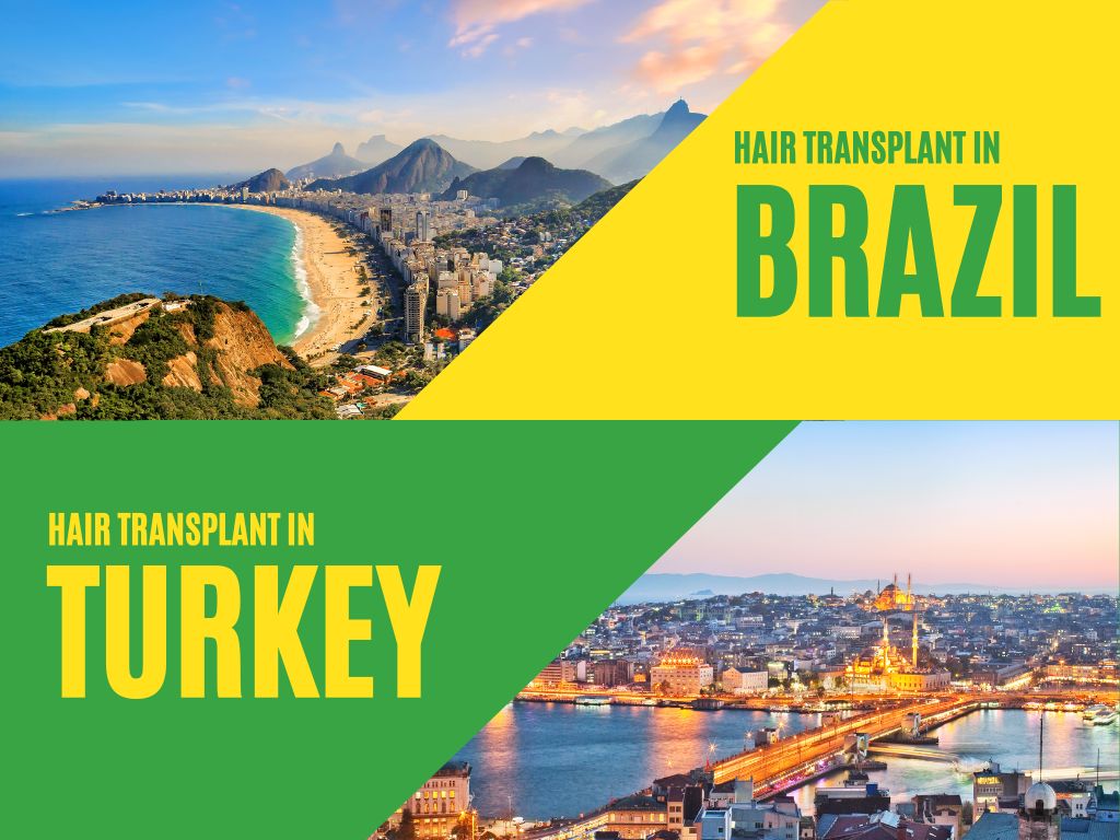 Hair-Transplant-Brazil-vs-Turkey-Country-Comparison Hair TransplantBrazil vs Turkey Country Comparison
