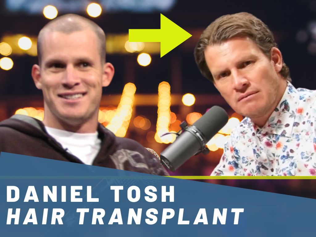 daniel tosh hair transplant analysis banner