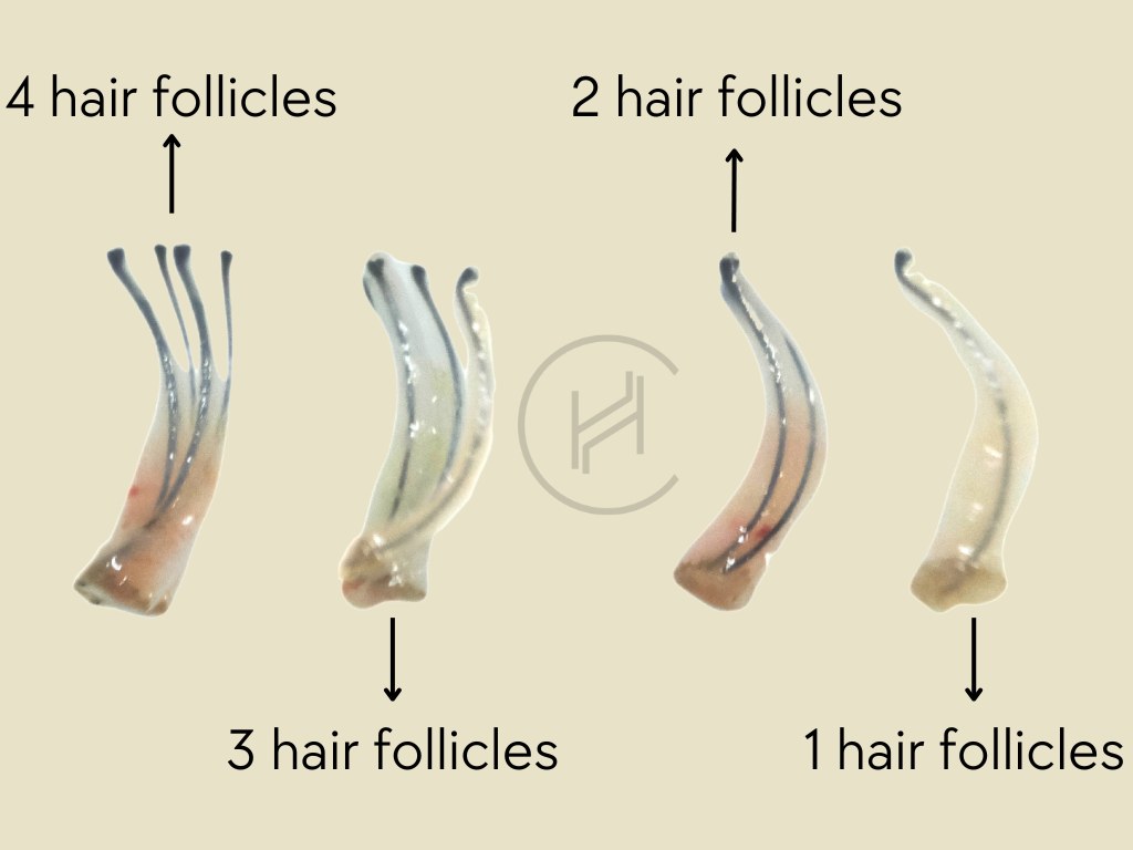 hair graft and follicles from one to four