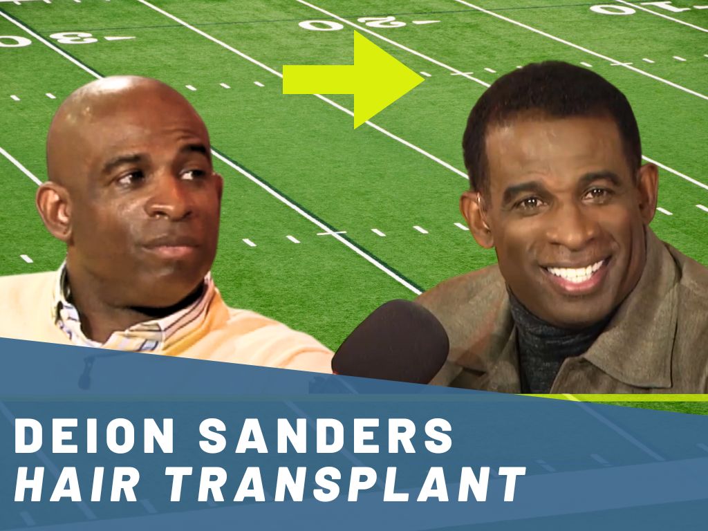 deion sanders hair transplant analysis banner