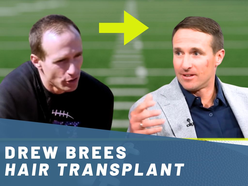 drew brees hair transplant analysis banner